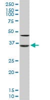Monoclonal Mouse anti-Human SORD / Sorbitol Dehydrogenase Antibody (clone 4D3, IHC, WB)