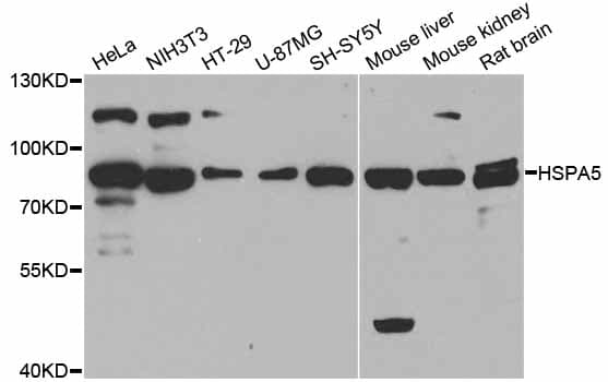 Polyclonal Rabbit anti-Human HSPA5 / GRP78 / BiP Antibody (WB)