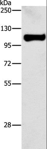 STAT6 Antibody