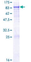Human HACL1 Protein (Recombinant GST)