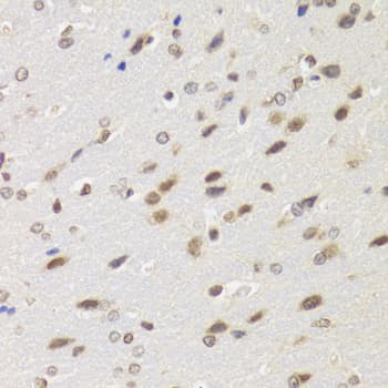 BAZ1B / WSTF Antibody