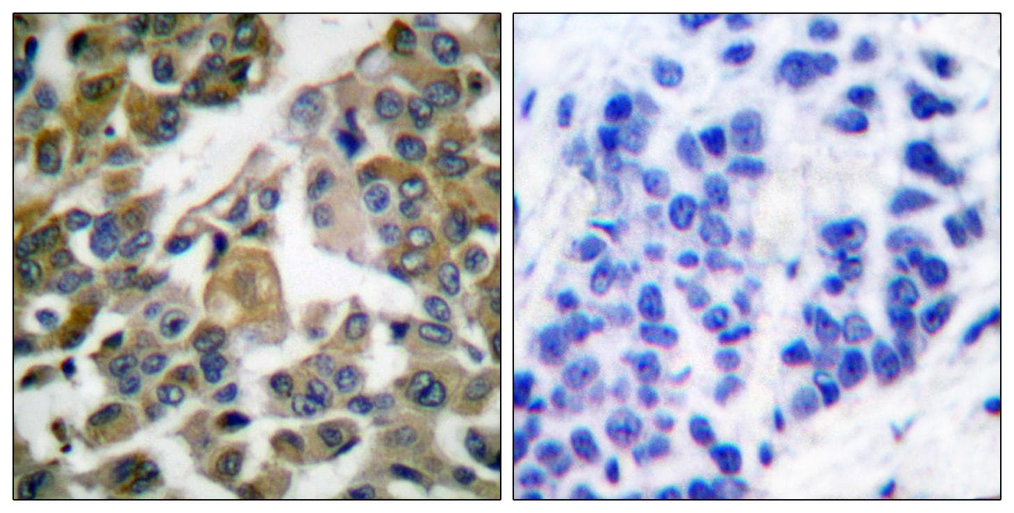 PLCG1 Antibody (p783)