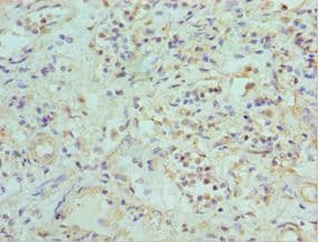 Polyclonal Rabbit anti-Human EFNB2 / Ephrin B2 Antibody (aa28-229, IHC, WB)