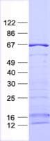 Human SGK3 Protein (Recombinant His, N-Terminal)