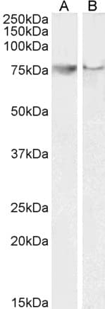 PTGS2 / COX2 / COX-2 Antibody (aa592-604)