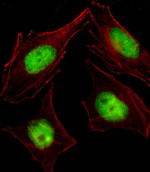 CBFA2T2 / MTGR1 Antibody (aa1-29)