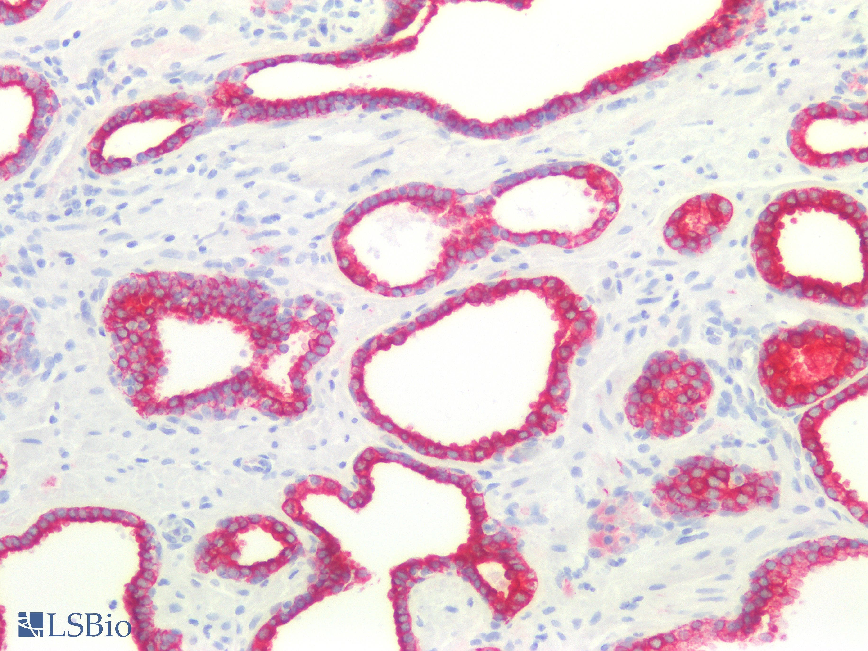 PathPlus™ KRT8 / CK8 / Cytokeratin 8 Antibody