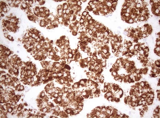 DECR1 Antibody (clone OTI7B11)