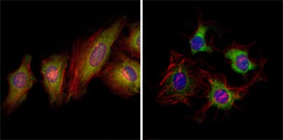 IHC-plus™ EPHB2 / EPH Receptor B2 Antibody (aa17-200, clone 2D12C6)