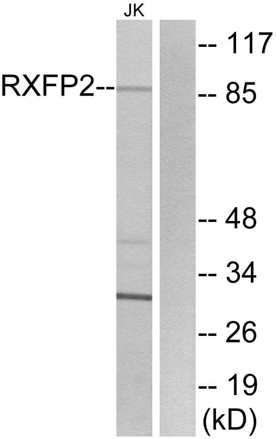 Polyclonal Rabbit anti-Human RXFP2 / LGR8 Antibody (WB)
