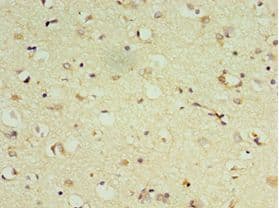 DRD3 / Dopamine Receptor D3 Antibody (aa213-329)