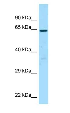 BCO1 / BCMO1 Antibody (aa189-238)
