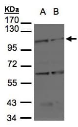 BMPR2 Antibody (aa667-951)
