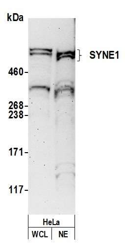 Polyclonal Rabbit anti-Human SYNE1 / Nesprin 1 Antibody (aa4200-4250, WB)