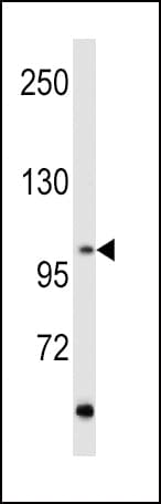 Polyclonal Rabbit anti-Human RET Antibody (aa13-44, WB)