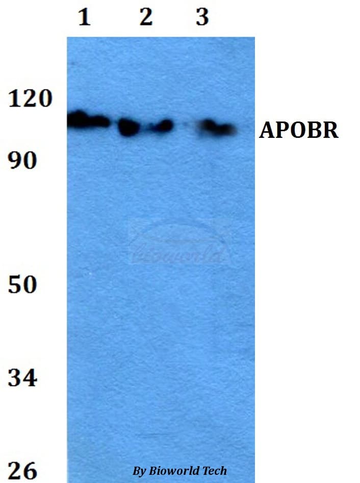 Polyclonal Rabbit anti-Human APOBR / APOB48R Antibody (IHC, WB)