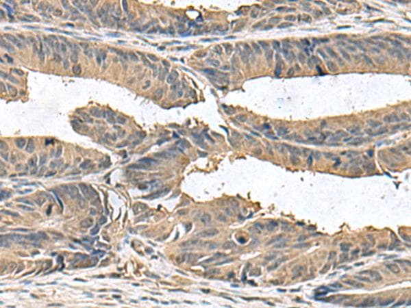 Polyclonal Rabbit anti-Human ZG16 Antibody (IHC, WB)