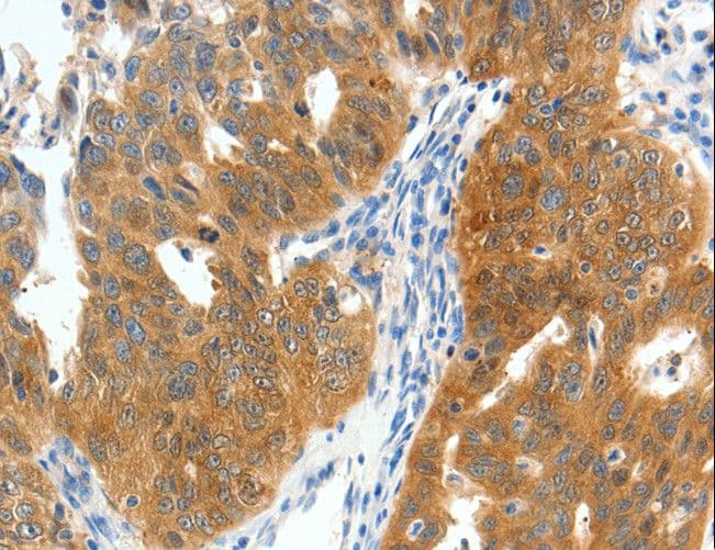 Polyclonal Rabbit anti-Human SCN9A / Nav1.7 Antibody (IHC)