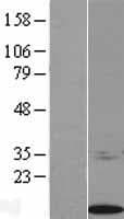 BCMP84 / S100A14 Protein (Over-Expression Lysate Myc-DDK (Flag))