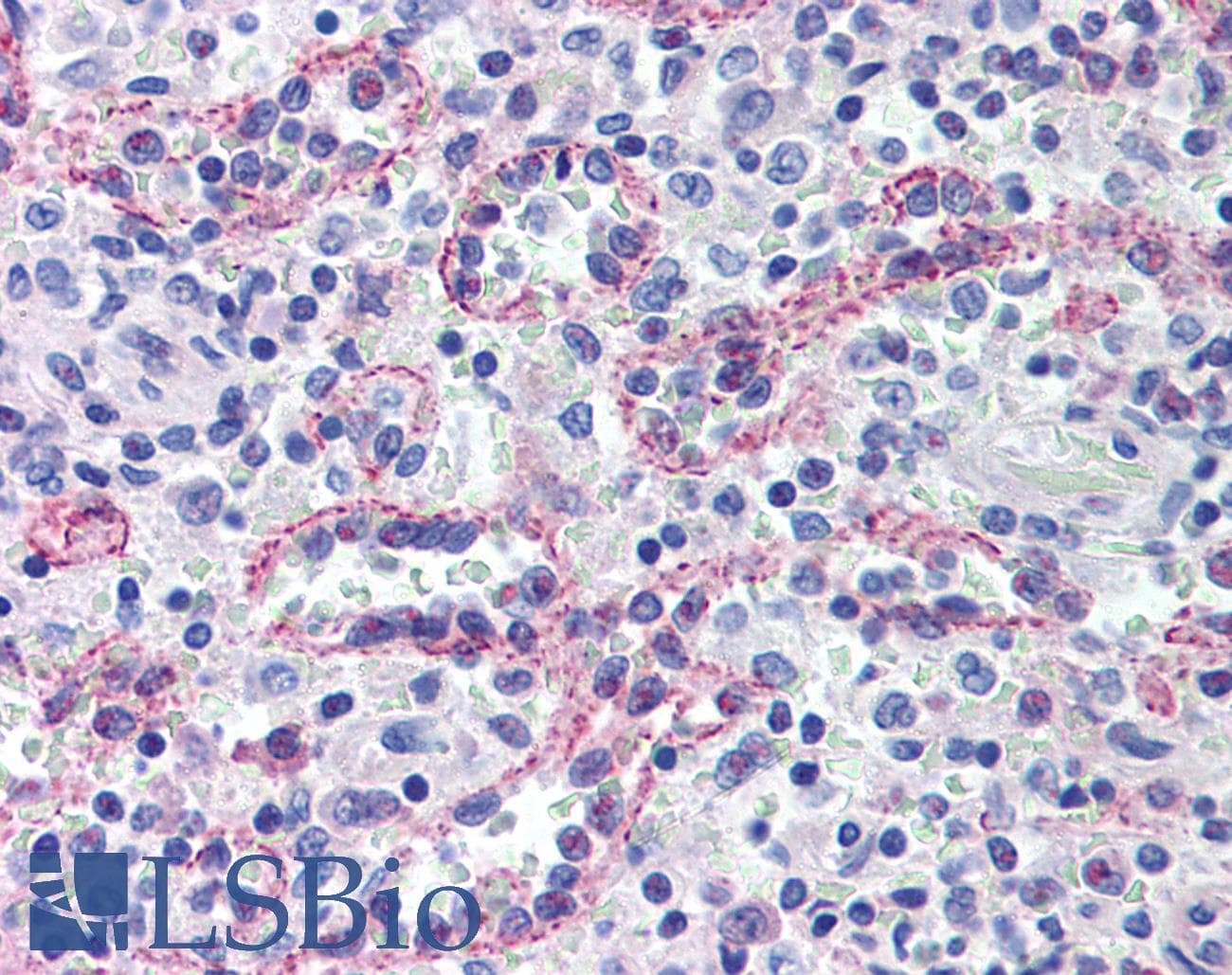 SPECC1 / CYTSB Antibody (aa200-300, DY488)