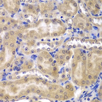 RPL5 / Ribosomal Protein L5 Antibody