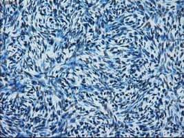 ERCC1 Antibody (clone OTI1A3)