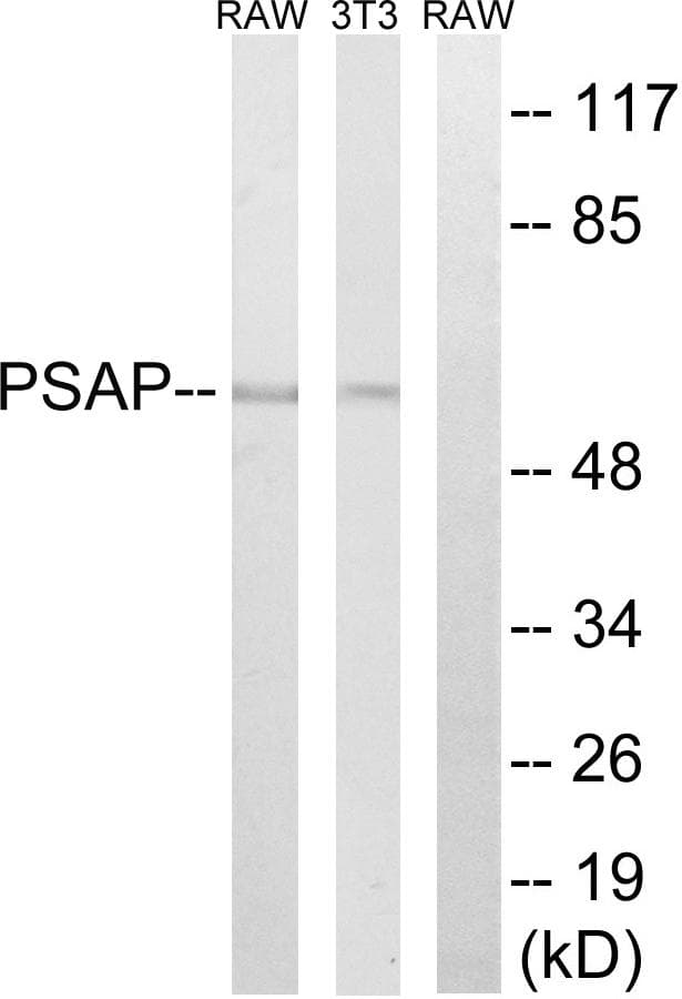 PSAP / Prosaposin Antibody