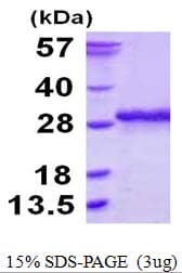 Human SSU72 Protein (Recombinant His)
