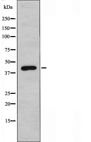 CHRM2 / M2 Antibody