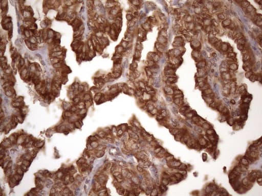 Monoclonal Mouse anti-Human TARBP2 / TRBP2 Antibody (clone OTI2C12, IHC, WB)