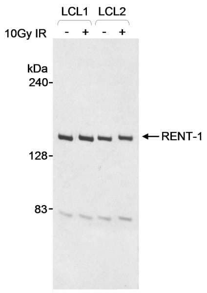 IHC-plus™ Polyclonal Goat anti-Human RENT1 / UPF1 Antibody (aa1075-C-term, IHC, WB)