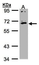 Polyclonal Rabbit anti-Human IL17RC Antibody (aa62-471, WB)