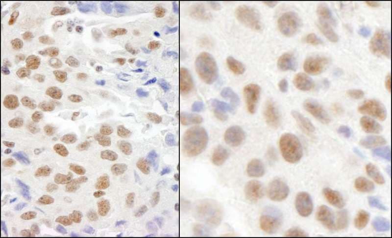 CMTR1 / FTSJD2 Antibody (aa100-150)