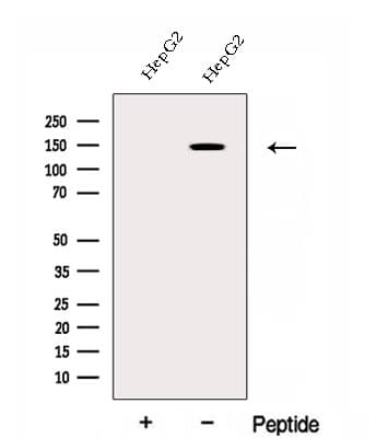 Polyclonal Rabbit anti-Human EHBP1 Antibody (WB)