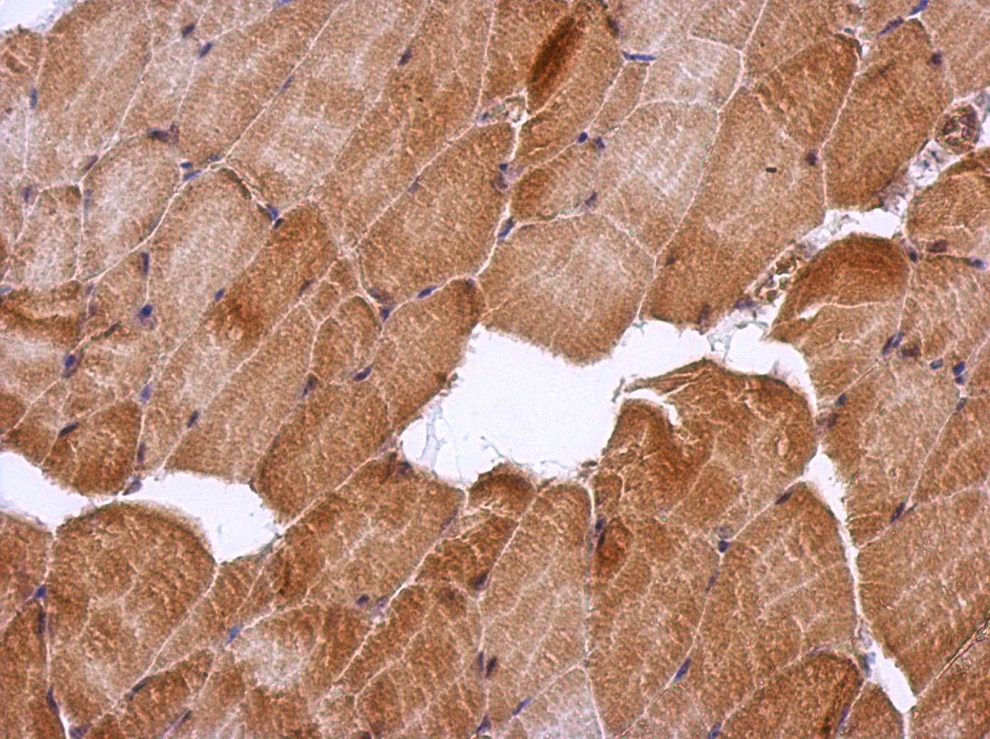 HSF2BP Antibody