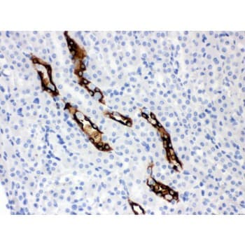 AQP2 / Aquaporin 2 Antibody (aa241-271)