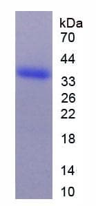 Rat ARG2 / Arginase 2 Protein (Recombinant 6His, N-terminus)