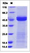 Rat Il11ra1 Protein (Recombinant His,C-terminus)