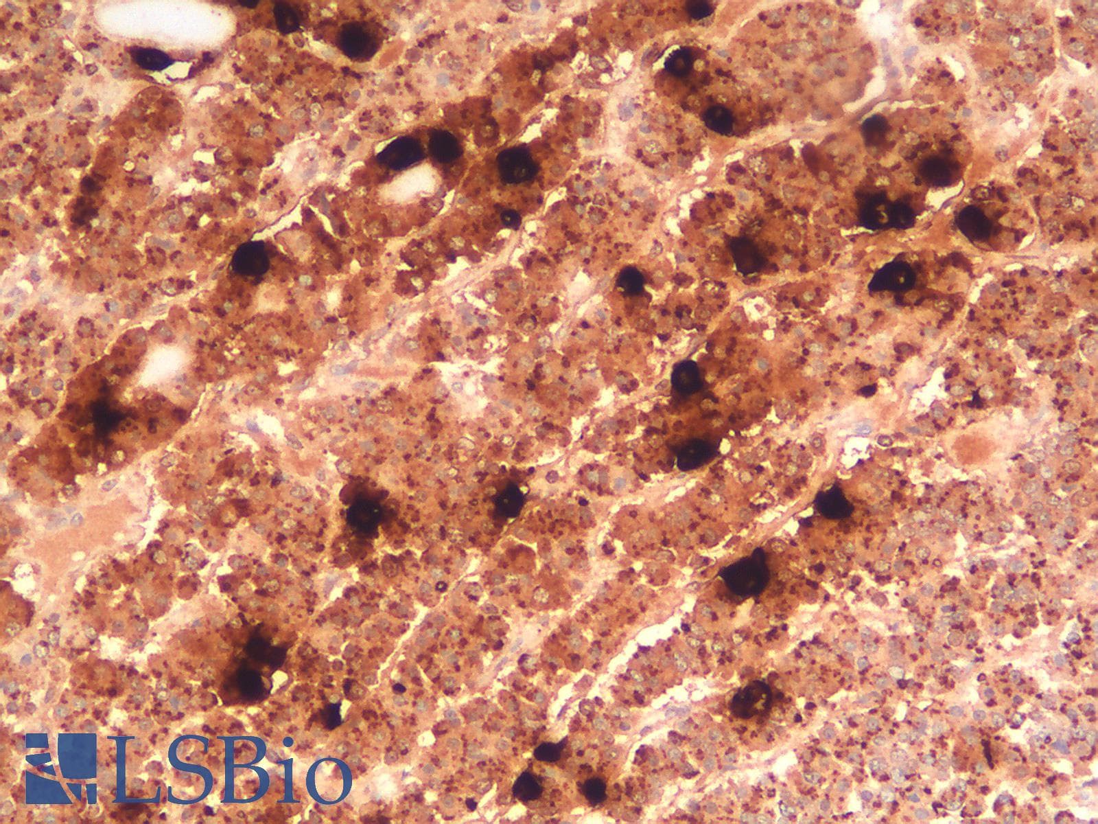 PathPlus™ Recombinant Monoclonal Mouse anti-Human POMC / Proopiomelanocortin Antibody (clone r57, N-Terminus, IHC)