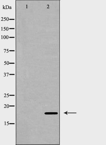 Polyclonal Rabbit anti-Human SOD1 / Cu-Zn SOD Antibody (WB)