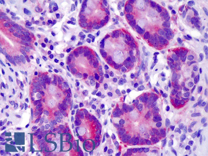IHC-plus™ Polyclonal Rabbit anti-Human ST14 / Matriptase Antibody (aa10-59, IHC, IF, WB)