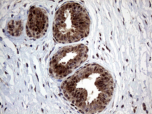 GLS2 / Glutaminase 2 Antibody (clone OTI1C12)