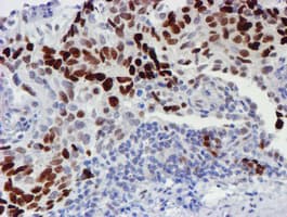 WWTR1 / TAZ Antibody (clone OTI1H9)
