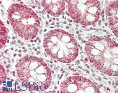 IHC-plus™ Polyclonal Rabbit anti-Human NCAPH / CAP-H Antibody (aa354-382, IHC, WB)