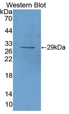 IL2RA / CD25 Antibody (aa22-243, PE)