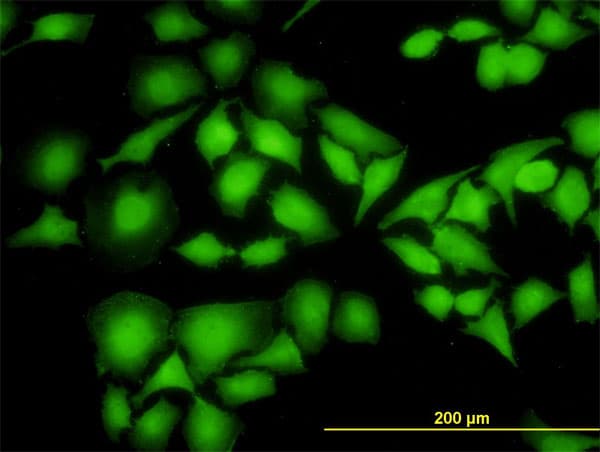 IHC-plus™ NME1 / NM23 Antibody (clone 1D7)