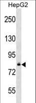 DGKB / DGK Beta Antibody (aa773-804)