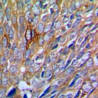PAK1 Antibody (Internal)