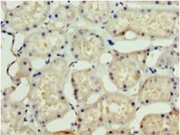 SSSCA1 / p27 Antibody