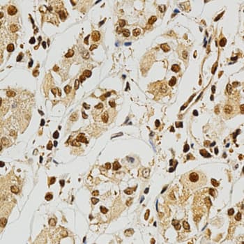 NFATC1 / NFAT2 Antibody